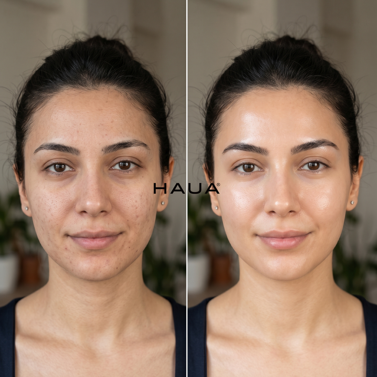 Hyaluronic PDRN Orb Serum Yoğun Nem & Dolgunlaştırıcı